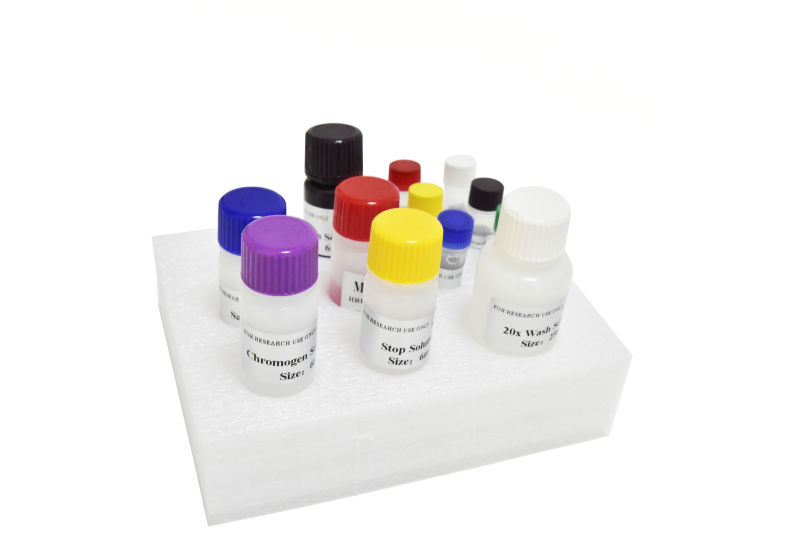 Human S100B(Protein S100-B) ELISA Kit